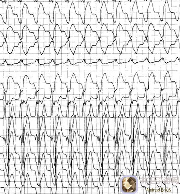 心动小镇5.11 溜溜木萤石秘境大探索！粉绿鸭带你速破隐藏奖励清单